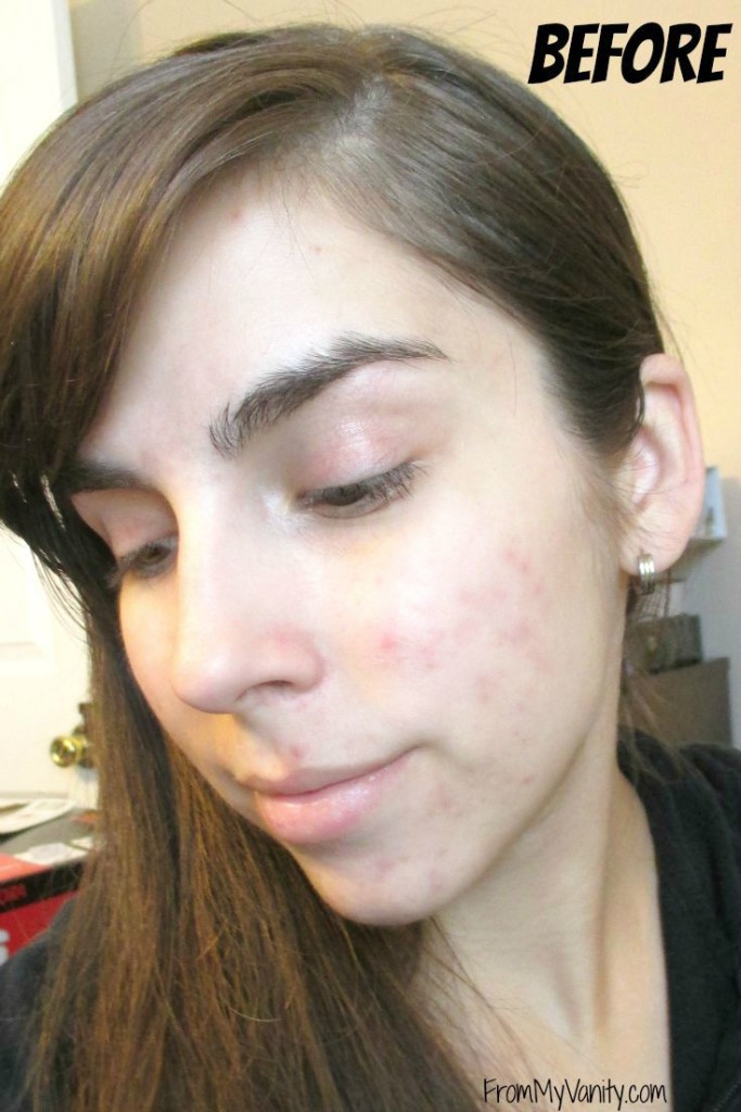 influenster-ysl-touch-eclat-blur-beforepics